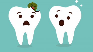 A Plaque Decaying teeth