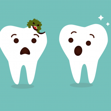 A Plaque Decaying teeth