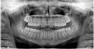 Sunrise Chatswood Dental X-Rays 
