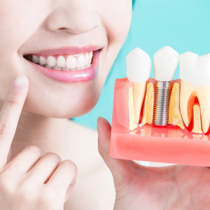 A woman smiling while holding a dental implant model